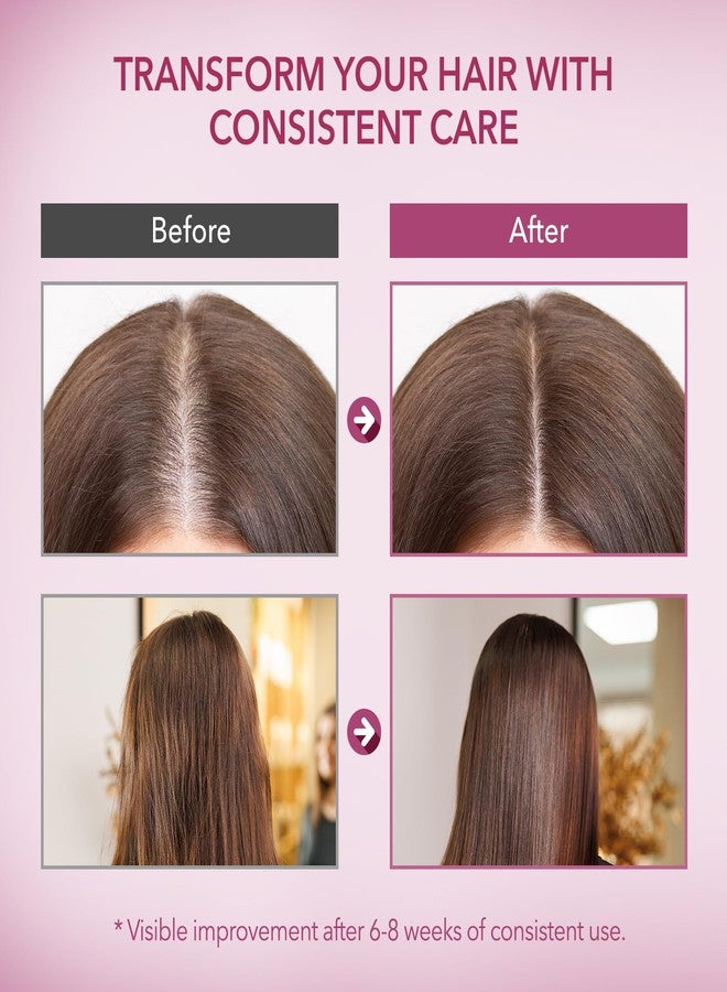 ProBliva Onion & Biotin Hair Growth Shampoo: Rosemary Infused Shampoo for Hair Loss and Thinning Hair - Promotes Healthier, Thicker and Stronger Hair for Women and Men - Image 5